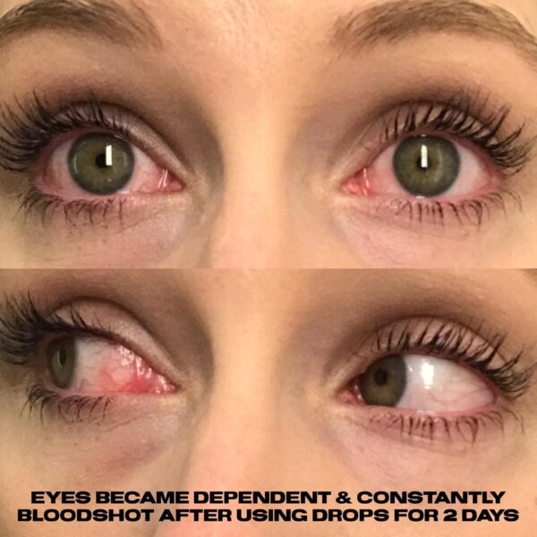 LUMIFY Redness Reliever Eye Drops - Image 5