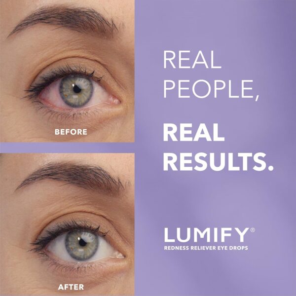LUMIFY Redness Reliever Eye Drops - Image 3