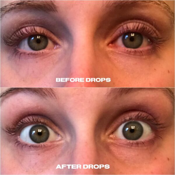 LUMIFY Redness Reliever Eye Drops - Image 4